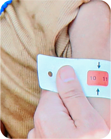 연이은 분쟁과 지진으로 식량이 부족해 영양 상태가 심각한 시리아의 라얀