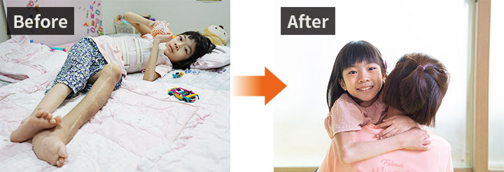 Before: 수술한 다리를 내밀고 침대에 누워있는 새롬이 / After: 엄마 품에 안겨 행복해하는 새롬이