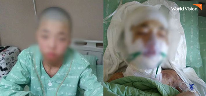 수술을 마치고 회복한 성훈이 모습. 사진