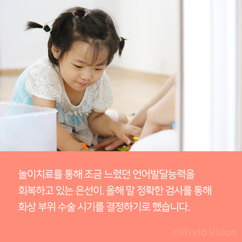 놀이치료를 통해 조금 느렸던 언어발달능력을 회복하고 있는 은선이. 올해 말 정확한 검사를 통해 화상 부위 수술 시기를 결정하기로 했습니다.